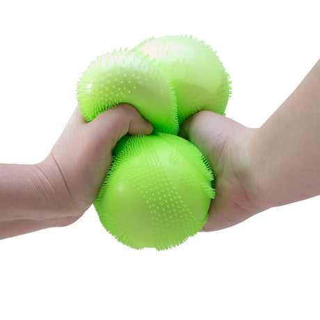 Two hands squeezing a textured, bright green fuzzy stress ball against a white background.